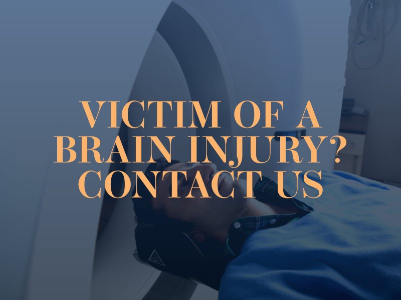 Irvine Brain Injury Attorney